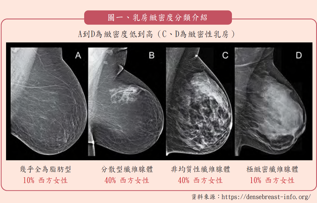 「乳房攝影」併行「乳房超音波檢查」 乳癌防治更完整 永越健康管理中心