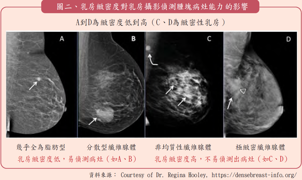 乳房攝影 併行 乳房超音波檢查 乳癌防治更完整 永越健康管理中心