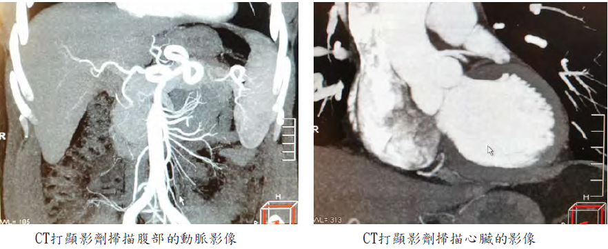 影像檢查常用顯影劑十問 永越健康管理中心